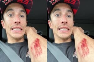 Terkuak Marc Marquez Alami Kecelakaan saat Latihan Flat Track Bersama Diogo Moreira
