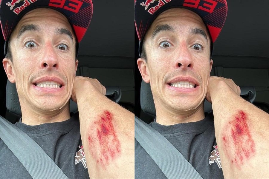 Terkuak Marc Marquez Alami Kecelakaan saat Latihan Flat Track Bersama Diogo Moreira